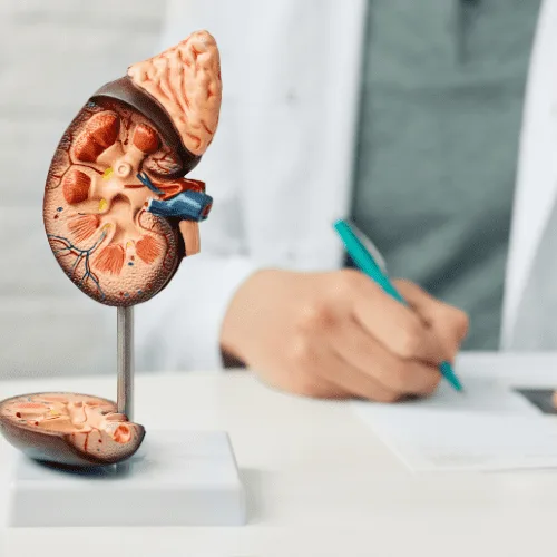 ¿Qué especialista trata el cáncer de vejiga en Guayaquil?